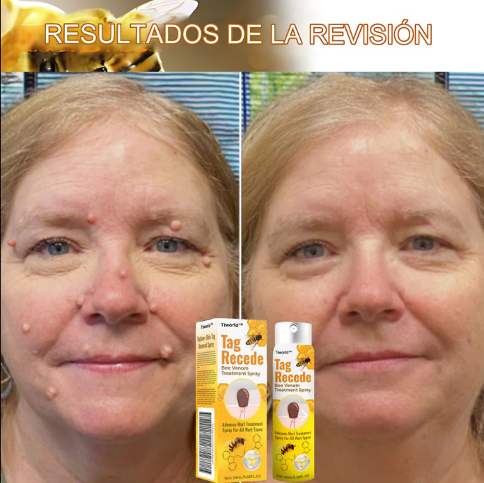 Crema para eliminar verrugas