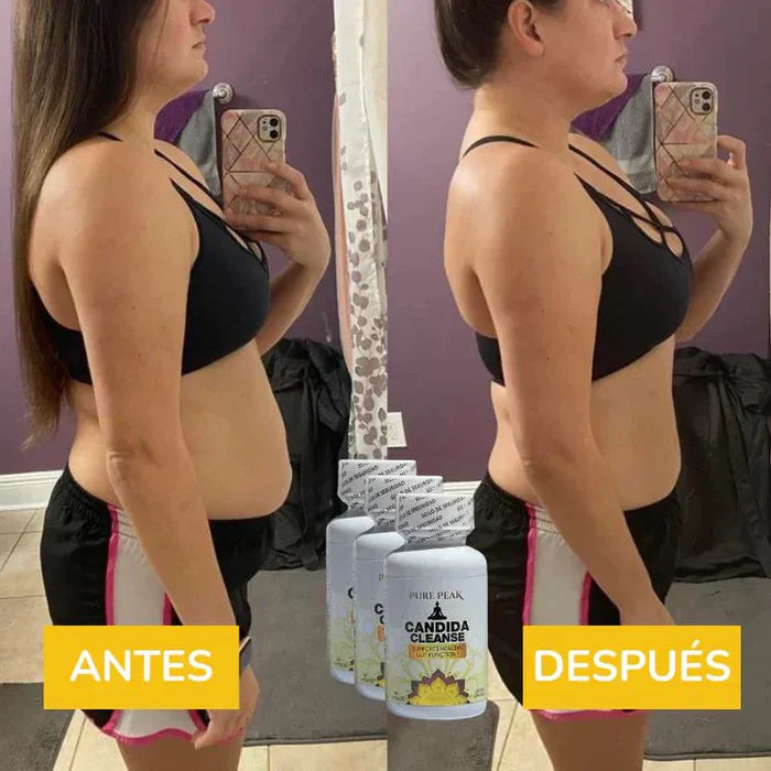 Candida Cleanse® — Fórmula natural para bienestar digestivo y equilibrio interno