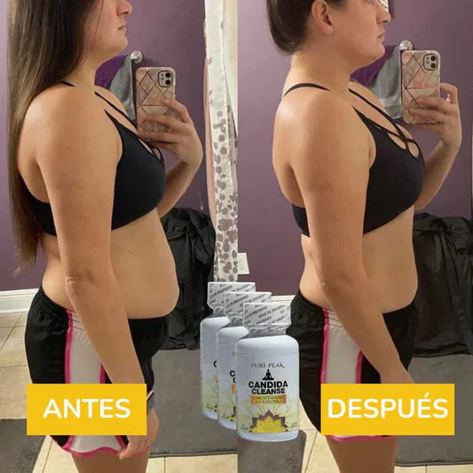 Candida Cleanse® — Fórmula natural para bienestar digestivo y equilibrio interno